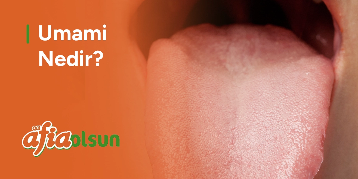 Umami Nedir? umami-nedir